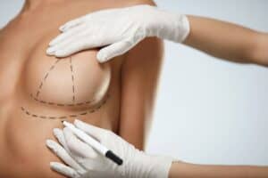 How to Fix Sagging Breasts